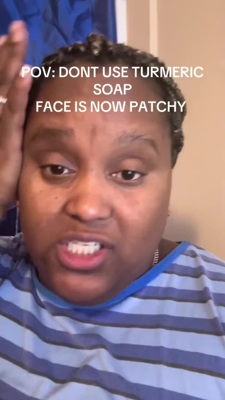 Dark spot eraser every woman swears by — Arbutin + FREE Shipping!