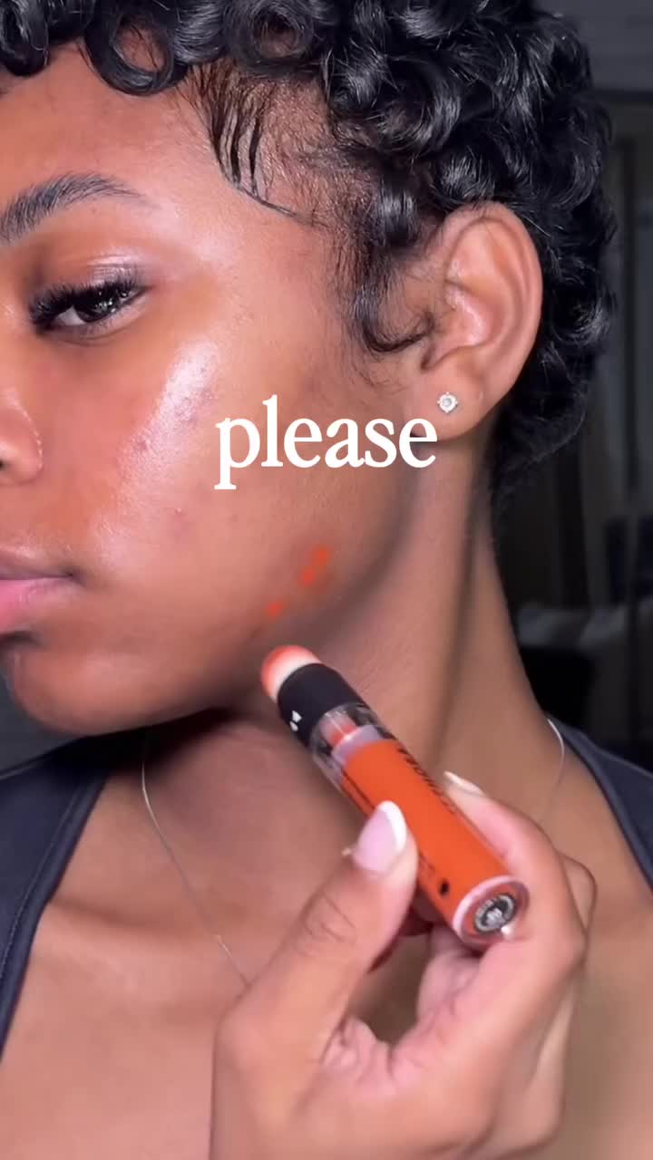 Dark spot eraser every woman swears by — Arbutin + FREE Shipping!